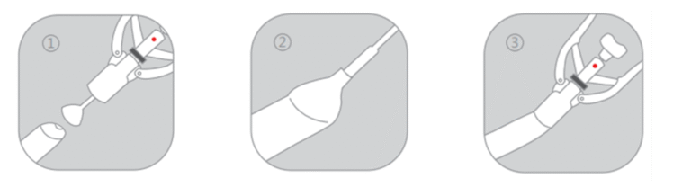 professional male circumcision